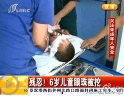 挖眼的视频,挖眼视频背后的恐怖真相