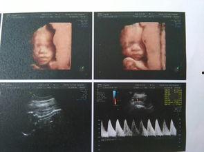 大排畸视频,胎儿发育全过程